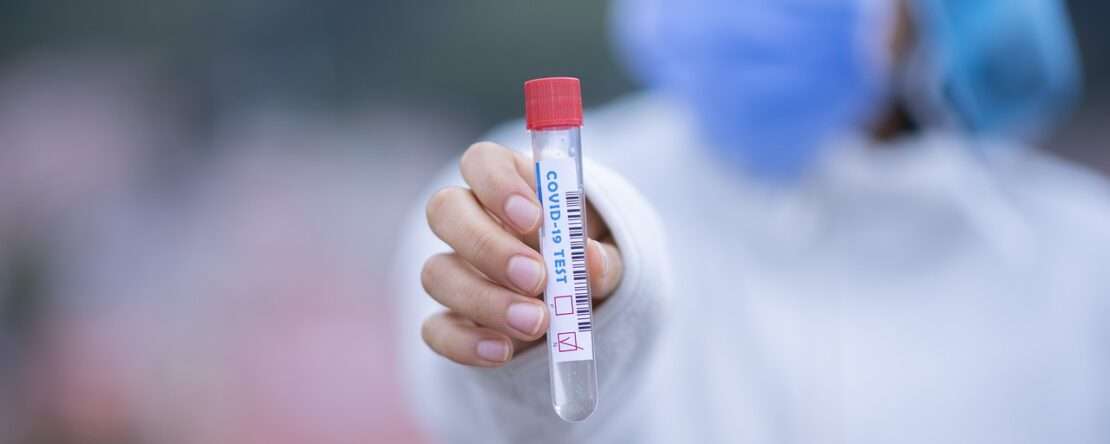 ПЦР-тест в аэропорту Минска