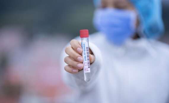 ПЦР-тест в аэропорту Минска